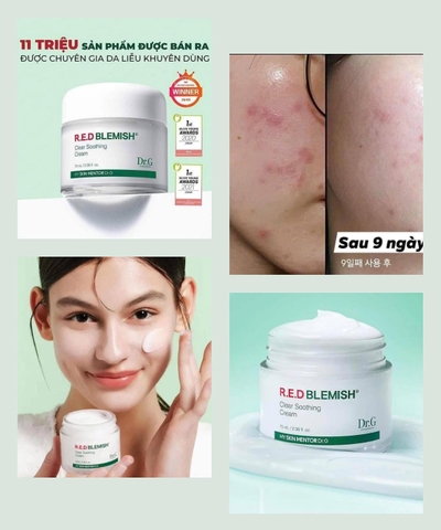 Kem 𝐃𝐑.𝐆 𝐑.𝐄.𝐃 𝐁𝐋𝐄𝐌𝐈𝐒𝐇 𝐂𝐋𝐄𝐀𝐑 𝐒𝐎𝐎𝐓𝐇𝐈𝐍𝐆 𝐂𝐑𝐄𝐀𝐌 da mụn