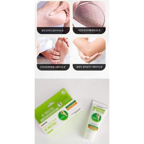Kem nứt nẻ gót chân mềm hồng gót hàn quốc Yougreen F 60g