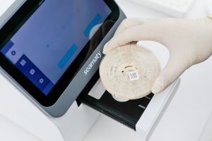 MÁY XÉT NGHIỆM SINH HÓA HÓA CHẤTKHÔ SD3