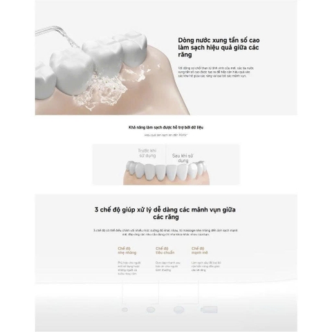 Tăm nước Vệ Sinh Răng Miệng Xiaomi Gen 2 Global MEO705