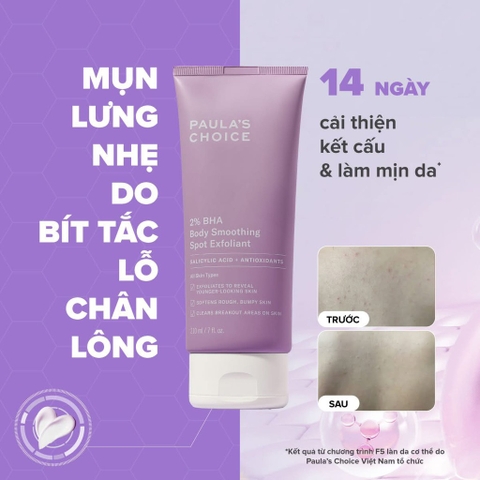 Kem Dưỡng Thể Paula's Choice Giảm Viêm Lỗ Chân Lông