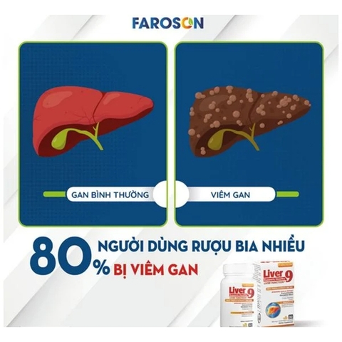 Viên Uống Giải Độc Gan Bảo Vệ Gan Faroson Liver 9