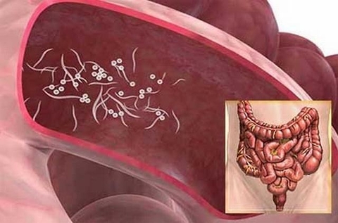 Tẩy Giun Hiểu Qua An Toàn Từ Dược Liệu Thiên Nhiên : Cây Thạch Lựu