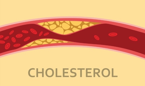 Giảm Cholesterol Trong Máu Nhờ Vị Thuốc Đông Y Xương Sáo