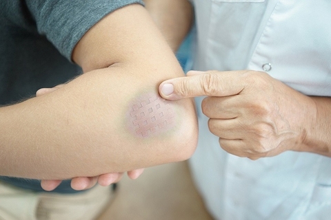 Cây Huyết Dụ Để Chữa Bị Thương Gây Ứ Máu, Phong Thấp