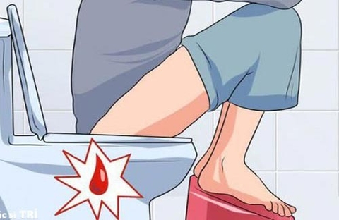Kiết Lỵ Ra Máu : Cách Phòng Ngừa Và Chữa Trị Từ Vị Thuốc Huyết Dụ