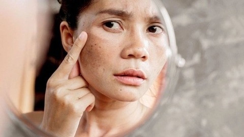 Hỗ Trợ Điều Trị Vết Thương, Chống Oxy Hoá : Cây Lu Lu Đực