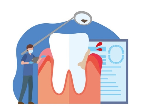 Phòng Ngừa Và Điều Trị Viêm Lợi Từ Cây Cỏ Bợ