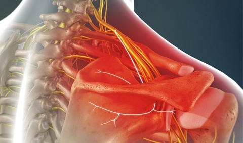 Đau Dây Thần Kinh Vai Gáy Và Cách Chữa Trị Từ Ngũ Gia Bì