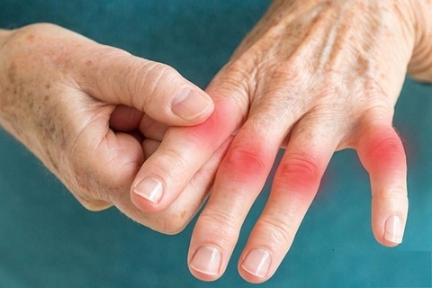 Điều Trị Phong Thấp Hiểu Quả Dứt Điểm Từ Vị Thuốc Đỗ Trọng