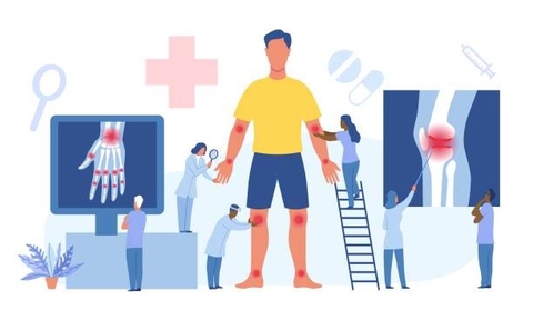 Xua Tan Đau Nhức Cải Thiện Tình Trang Thấp Khớp Của Găng Tu Hú