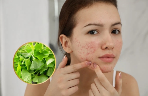 Thói Quen Để Có Làn Da Khoẻ Mạnh Sạch Mụn Hết Nám Với Rau Má