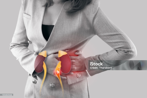 Cây Rau Om Và Thói Quen Sử Dụng Điều Trị Sỏi Thận