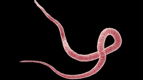 Công Dụng Tẩy Giun Của Sứ Quân Tử Mà Ít Ai Biết Loại Bỏ Ngay Giun Sán Hiệu Quả