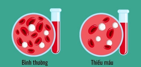 Vị Thuốc Vọng Cách Trong Chữa Trị Bệnh Thiếu Máu