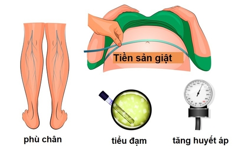 Tiền Sản Giật Là Gì ? phòng Ngừa Với Vị Thuốc Câu Đằng Y Học Cổ Truyền