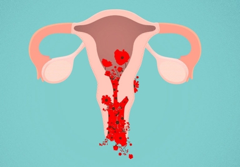 Phòng Ngừa Và Điều Trị Xuất Huyết Tử Cung Từ Cây Cỏ Nến