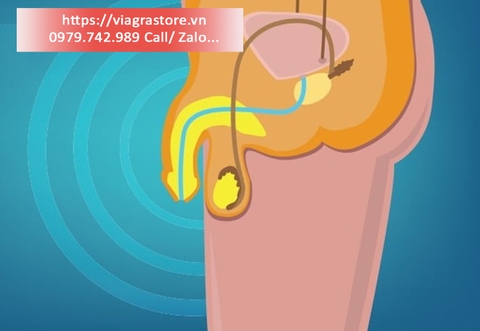 Yếu sinh lý: Nguyên nhân, dấu hiệu, chẩn đoán, cách điều trị