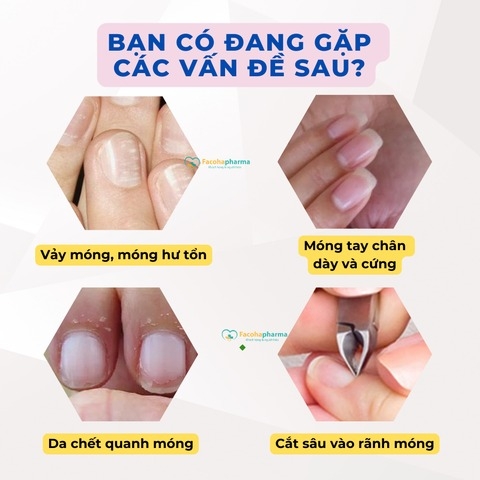 Kềm cắt da móng tay tiện lợi và bộ dụng cụ vệ sinh móng chuyên dụng