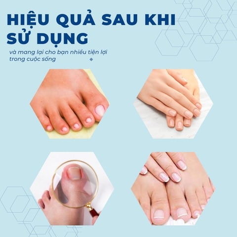 Kềm cắt da móng tay tiện lợi và bộ dụng cụ vệ sinh móng chuyên dụng