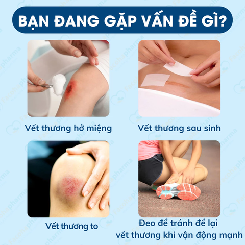 Băng dán cá nhân bản to thoáng khí có gạc vô khuẩn, bảo vệ vết thương hiệu quả đóng gói từng miếng nhiều size