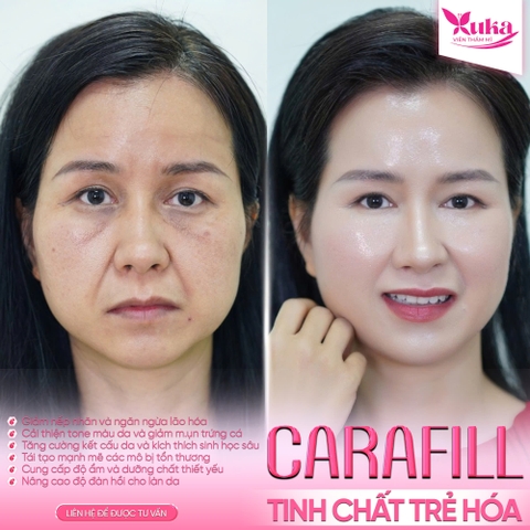 TRẺ HÓA DA TOÀN DIỆN