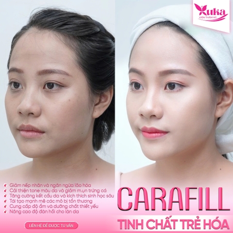 ĐIỀU TRỊ DA LÃO HÓA CẢI THIỆN NẾP NHĂN