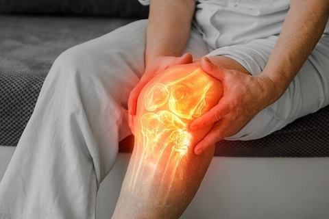 Bệnh nhân bị khô khớp uống thuốc gì? Các lựa chọn và lưu ý an toàn