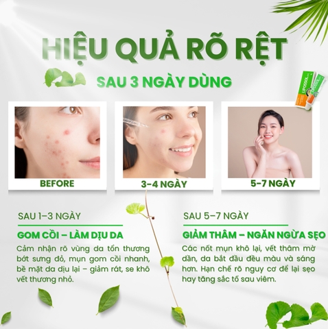 Lipossol – Giải pháp phục hồi và ngừa sẹo hiệu quả cho làn da tổn thương