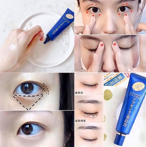 Kem trị thâm chống nhăn mắt Meishoku Whitening Eye Cream 30g – Dưỡng sáng vùng da mắt, mờ quầng thâm, giảm nếp nhăn hiệu quả