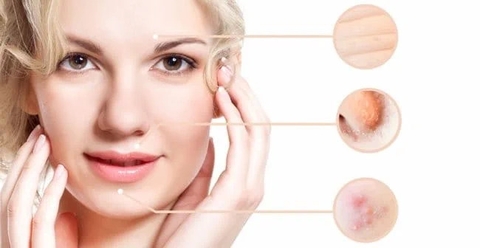 Collagen là gì? Tác dụng của Collagen đối với sức khỏe của làn da