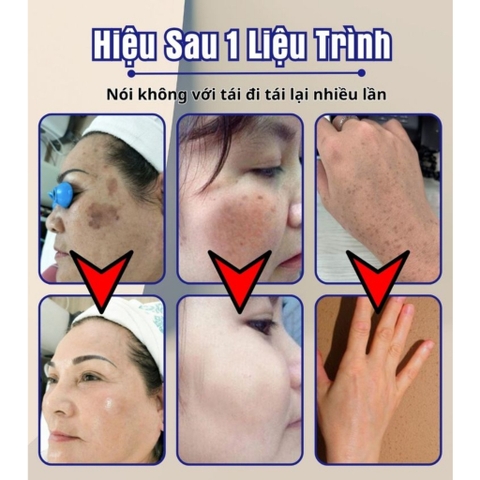 Kem bôi đồi mồi nám tàn nhang Dr.Li - Kem Dr.Li đồi mồi body và mặt giúp da trắng sáng 20g  - HTHshop102