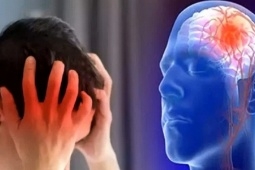3 bất thường liên quan giấc ngủ cảnh báo nguy cơ nhồi máu não