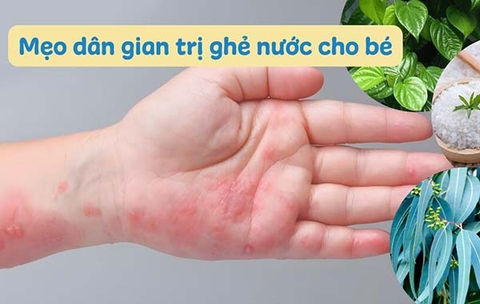 Trẻ bị ghẻ nước tắm lá gì? Mẹo dân gian trị ghẻ nước cho bé hiệu quả