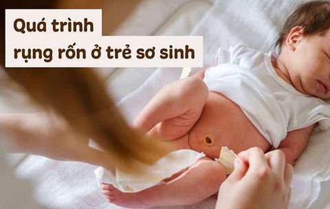 Quá trình rụng rốn ở trẻ sơ sinh, hình ảnh rốn trẻ sơ sinh sau khi rụng giúp mẹ dễ nhận biết