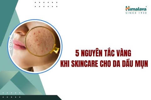 5 nguyên tắc vàng khi skincare cho da dầu mụn