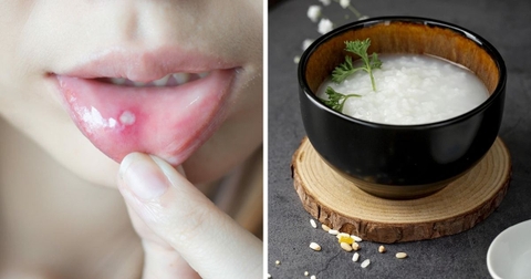 Bị Nhiệt Miệng Nên Ăn Gì và Kiêng Gì? — Danh Sách Thực Phẩm Chuẩn Nhất Bạn Nên Biết