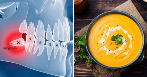 Chế Độ Ăn Sau Khi Nhổ Răng Khôn: Nên Ăn Gì – Kiêng Gì Để Tránh Biến Chứng