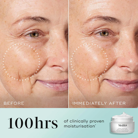 MEDIK8 TOTAL MOISTURE DAILY FACIAL CREAM/ KEM DƯỠNG ẨM CHUYÊN SÂU-PHỤC HỒI HÀNG RÀO BẢO VỆ DA