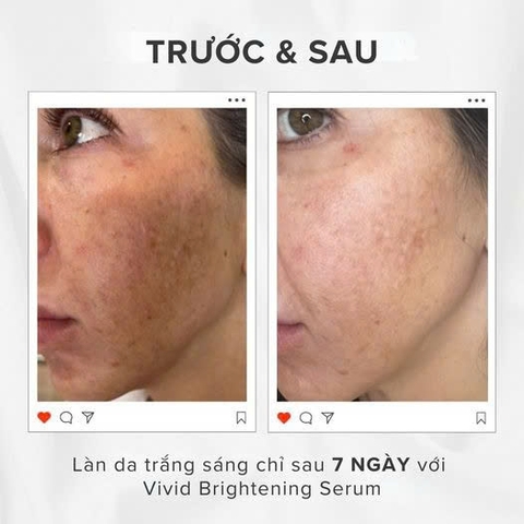 HYDRINITY VIVID BRIGHTENING SERUM: Tinh Chất Làm Sáng Da & Cấp Ẩm Vượt Trội Với Công Nghệ RPH™ Độc Quyền