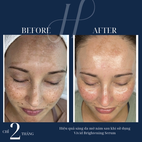 HYDRINITY VIVID BRIGHTENING SERUM: Tinh Chất Làm Sáng Da & Cấp Ẩm Vượt Trội Với Công Nghệ RPH™ Độc Quyền