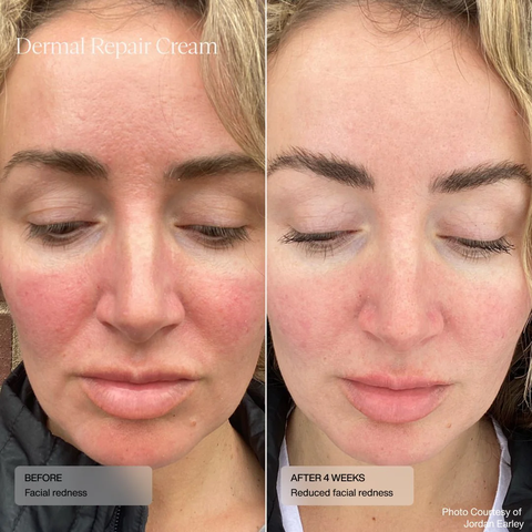 SANTÉ DERMAL REPAIR CREAM/ KEM DƯỠNG PHỤC HỒI VÀ NUÔI DƯỠNG LÀN DA