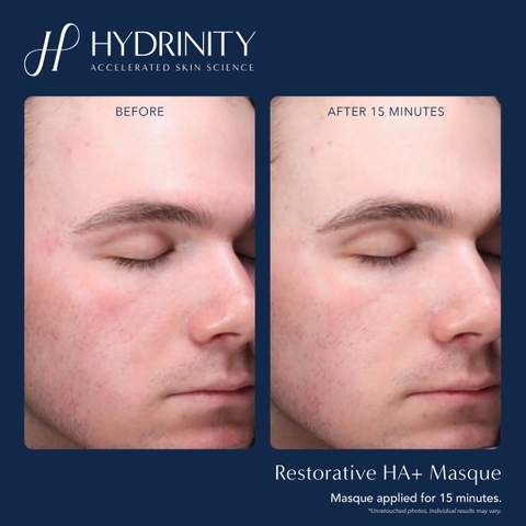 Hydrinity Restorative HA+ Masque: Mặt Nạ Phục Hồi Cao Cấp - "Lớp Da Thứ Hai" Tái Sinh Làn Da Tổn Thương