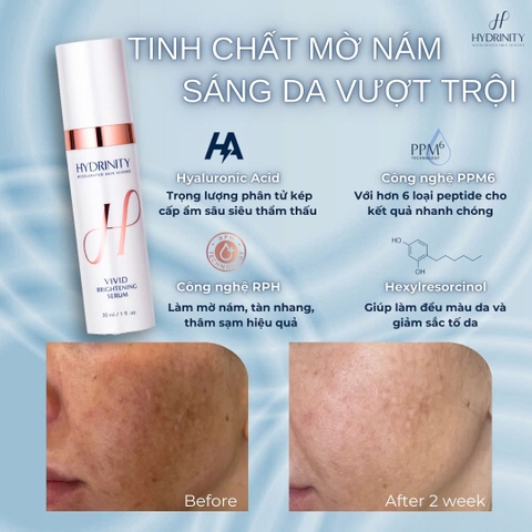 HYDRINITY VIVID BRIGHTENING SERUM: Tinh Chất Làm Sáng Da & Cấp Ẩm Vượt Trội Với Công Nghệ RPH™ Độc Quyền