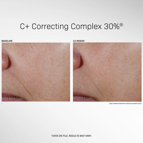 REVISION SKINCARE C+ Correcting Complex 30%- SERUM LÀM SÁNG, GIẢM NÁM, TRẺ HOÁ DA