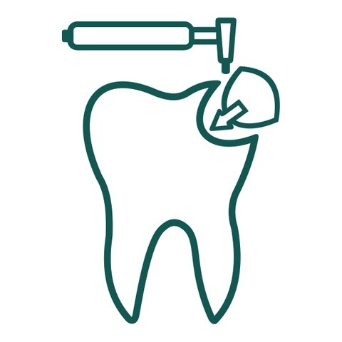 Vật Liệu Trám Răng