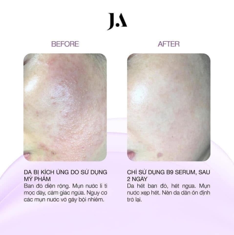 Serum Juliette Armand B9 20ml