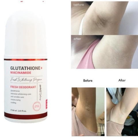 Lăn khử mùi Angel's Liquid Glutathione