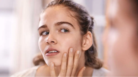 Cẩm nang chăm sóc da mụn hiệu quả cho làn da khỏe mạnh