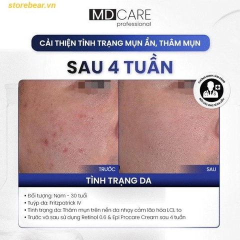 Kem dưỡng và cải thiện nếp nhăn PRO-Retinol 0.6 30ml